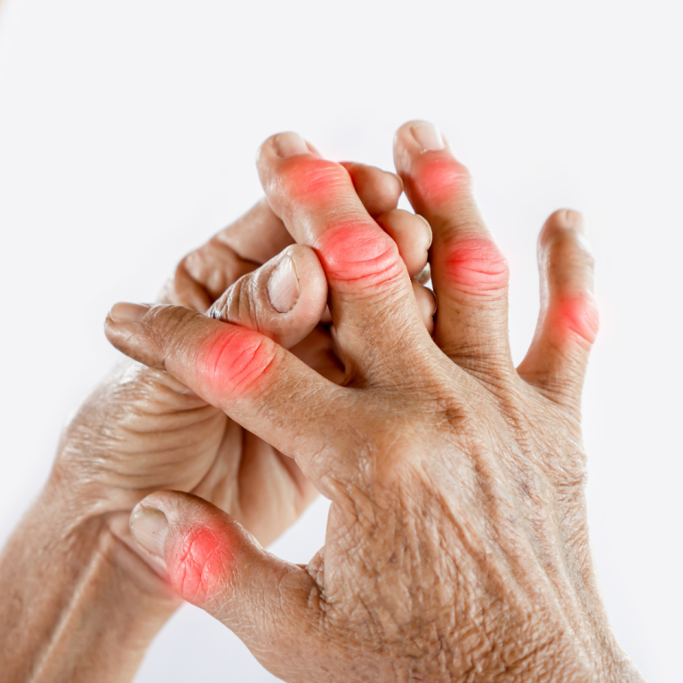 hand specialist examining patient with hand pain Mbombela